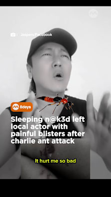 He was in so much pain that he thought he had shingles. #8dayssg #8dayssglocalent #singapore #fyp #information 