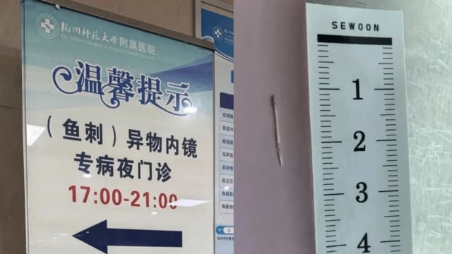 年年有“鱼”惹祸？除夕夜17人鱼刺卡喉医院忙到手软