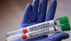 Indonesia lapor 2 kes disyaki hantavirus