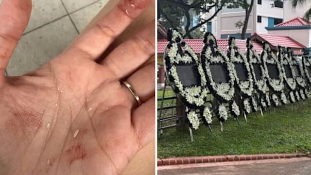 强风吹倒沉重电子花圈 砸中女子致两颗门牙断裂