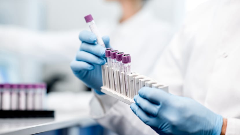 Commentary: Your leftover blood samples are valuable to science – but they are often discarded