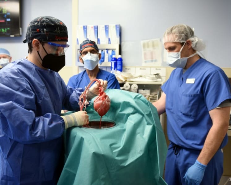Commentary: Genetically engineered pigs may shorten organ transplant wait list