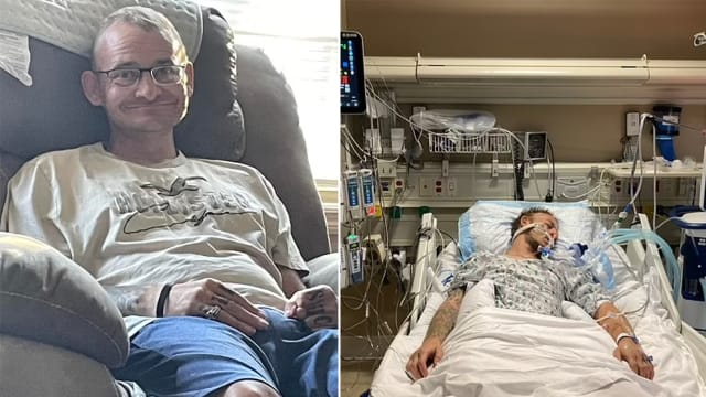 器官摘到一半 美国脑死病患“复活” 吓坏医护人员