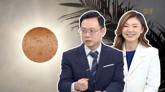 狮城有约 | 天气热阳光强 你懂得防晒吗？