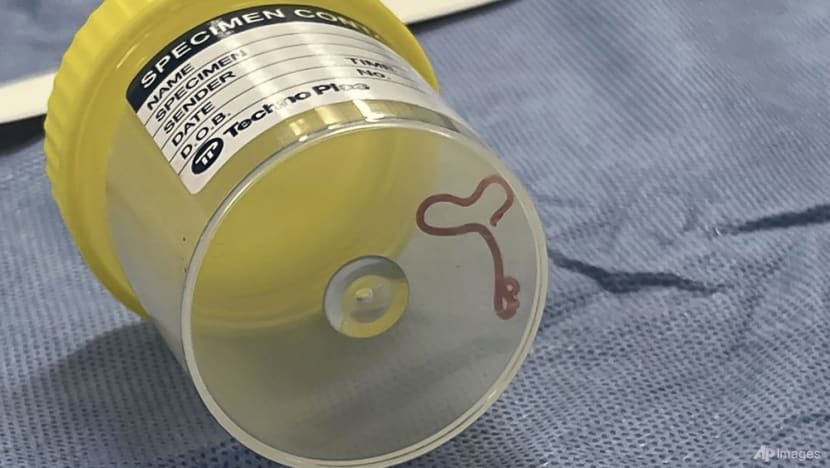 Commentary: Brain worms are rare - but other forms of parasitic infection are common Commentary: Brain worms are rare - but other forms of parasitic infection are common