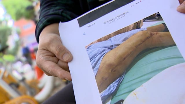 推拿喊痛却持续施力致七旬翁骨折 家属怒告按摩馆