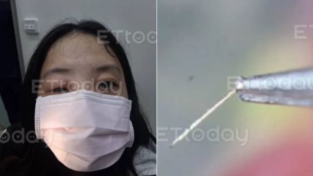 疑因香水引蜜蜂飞入头盔 台湾女子眼睛遭蜇伤