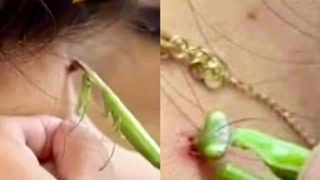 成都女子抓螳螂吃掉颈后疣  医生提醒存感染风险切勿模仿