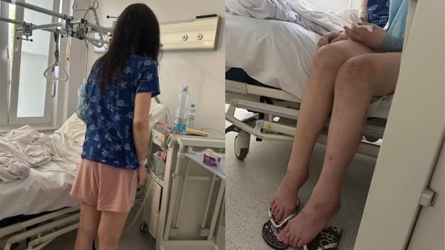 波兰女被囚禁当性奴 惨遭虐待嘴唇牙齿都没了