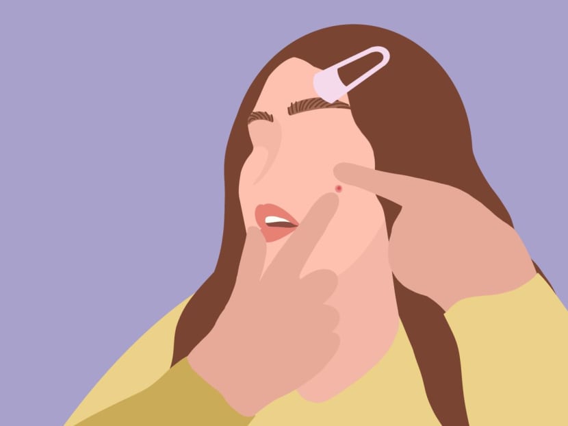 What is stress acne and how do you deal with it? Is that why you keep getting zits before an important event? What is stress acne and how do you deal with it? Is that why you keep getting zits before an important event?