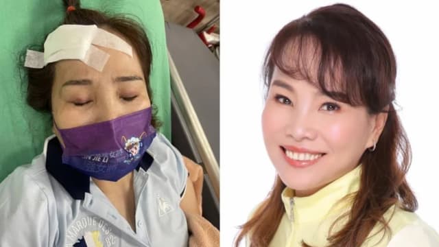 台湾新党候选人林婕丽竞选期间遭人殴打入院