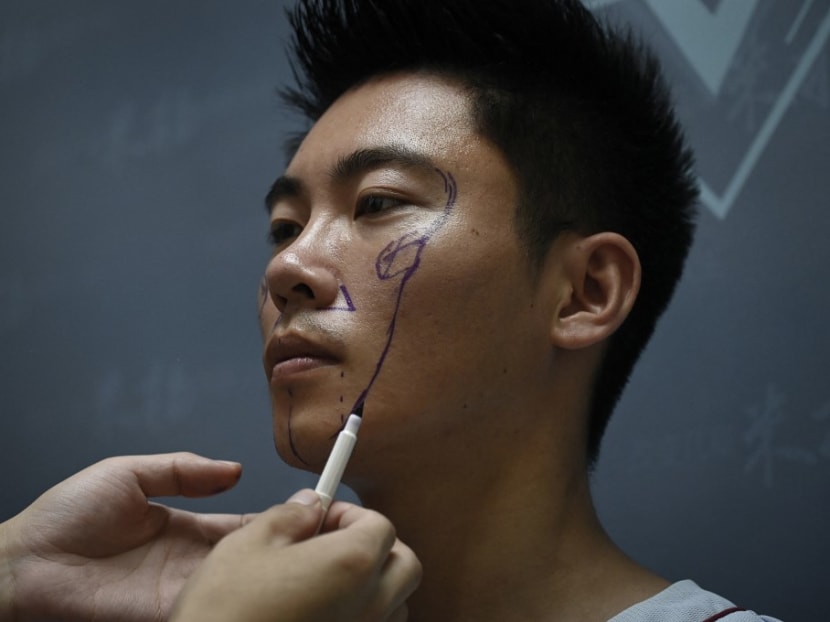 This picture taken on July 15, 2021 shows a doctor marking scientific researcher Xia Shurong's face before getting plastic surgery at a clinic in Beijing. This picture taken on July 15, 2021 shows a doctor marking scientific researcher Xia Shurong's face before getting plastic surgery at a clinic in Beijing.
