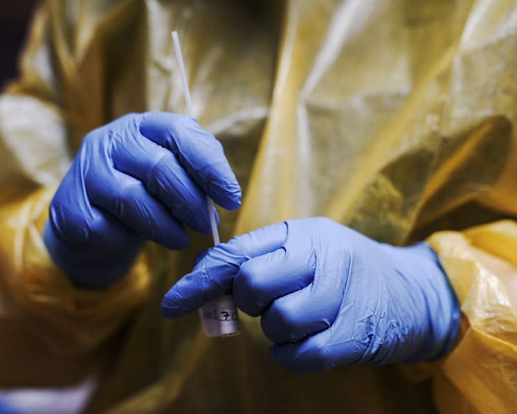 No reports of 'long Covid’ cases in Singapore so far: MOH