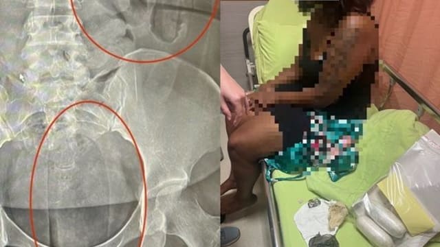 吞50颗海洛因胶囊身体私处藏毒品 11人涉跨国走私毒品台湾落网