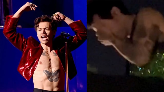 One Direction成员Harry Styles遭粉丝砸伤，表情痛苦！