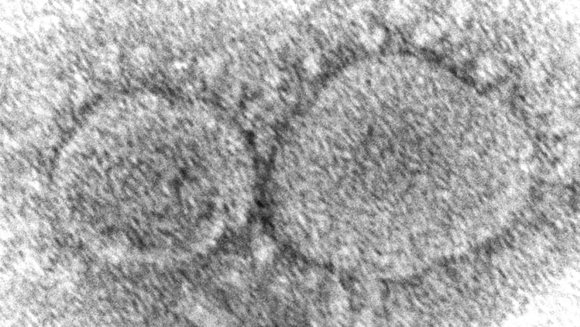 CIA says COVID-19 'more likely' to have leaked from lab CIA says COVID-19 'more likely' to have leaked from lab