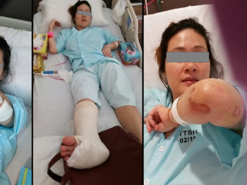 Ms Chan Hui Peng pictured in hospital after she fell into a manhole. Ms Chan Hui Peng pictured in hospital after she fell into a manhole.