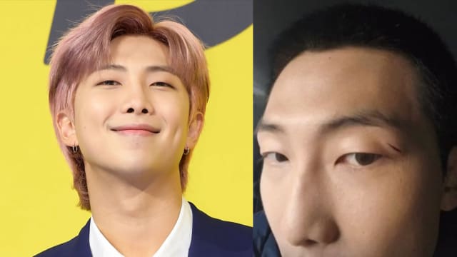 BTS队长RM自曝拍摄受伤　眼睛上方缝针！