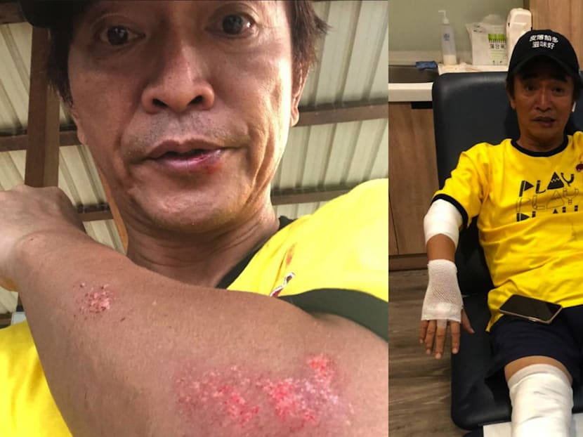Jacky Wu Crashes Bike While Filming Variety Show; Says His Helmet