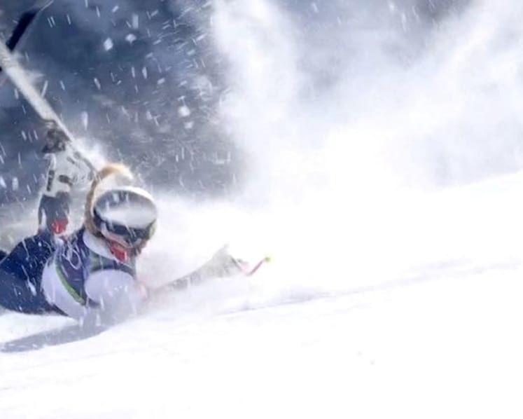 Alpine skiing-Vonn has surgery on broken leg after horror crash in Cortina downhill