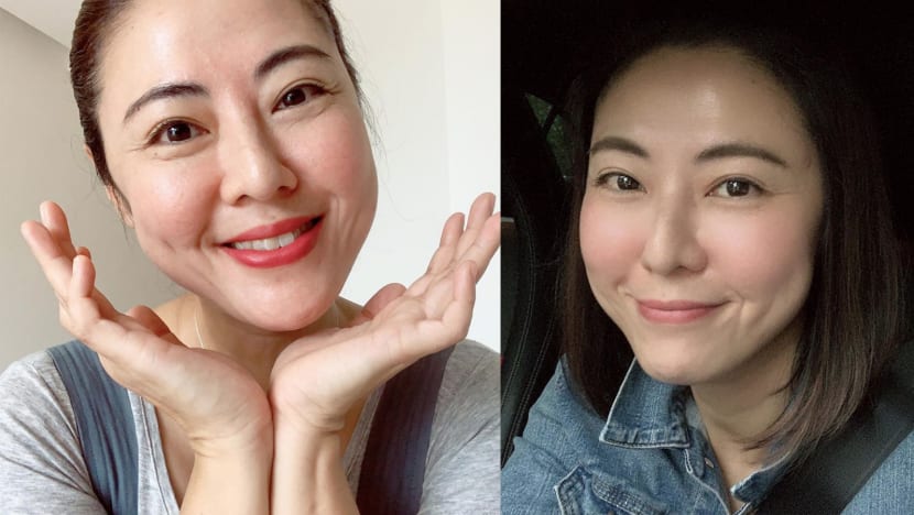 Cynthia Koh, Who Is Now Selling Skincare Products, Had Such Bad Acne, She Was Told She Had No Good Angles Cynthia Koh, Who Is Now Selling Skincare Products, Had Such Bad Acne, She Was Told She Had No Good Angles