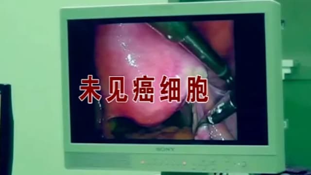 武汉男子被误诊胃癌切除全胃 法院判医院疏失须赔逾4万新元