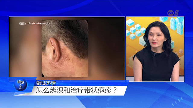狮城有约 | 患上带状疱疹不仅限于年长者 该如何识别与预防？