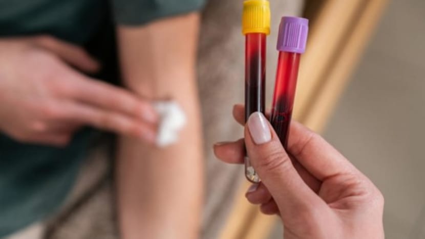 Siapa boleh menderma darah: Adakah mereka yang mempunyai tatu, tindik di badan dan kolesterol tinggi layak? Siapa boleh menderma darah: Adakah mereka yang mempunyai tatu, tindik di badan dan kolesterol tinggi layak?