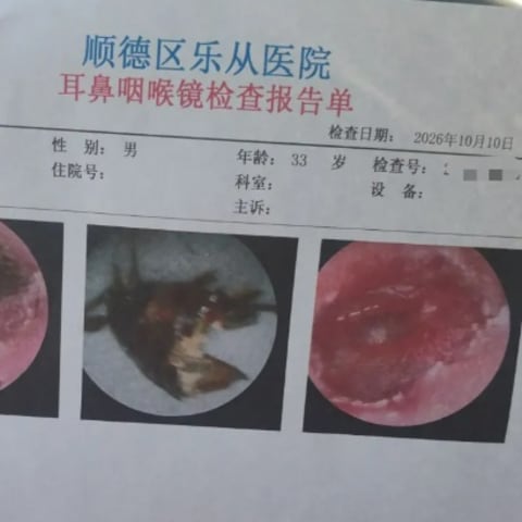 蟑螂钻耳男子自行冲水 隔近一周就医耳膜险穿孔