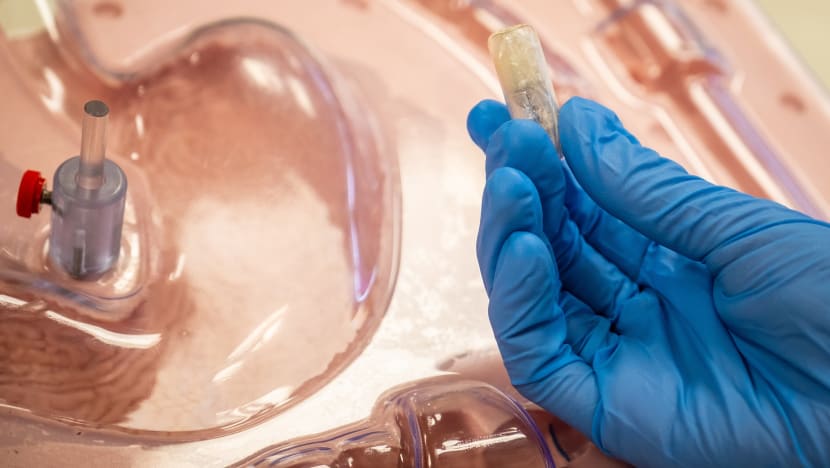 NTU, NUHS develop 'pill' that inflates in stomach to help treat obesity NTU, NUHS develop 'pill' that inflates in stomach to help treat obesity