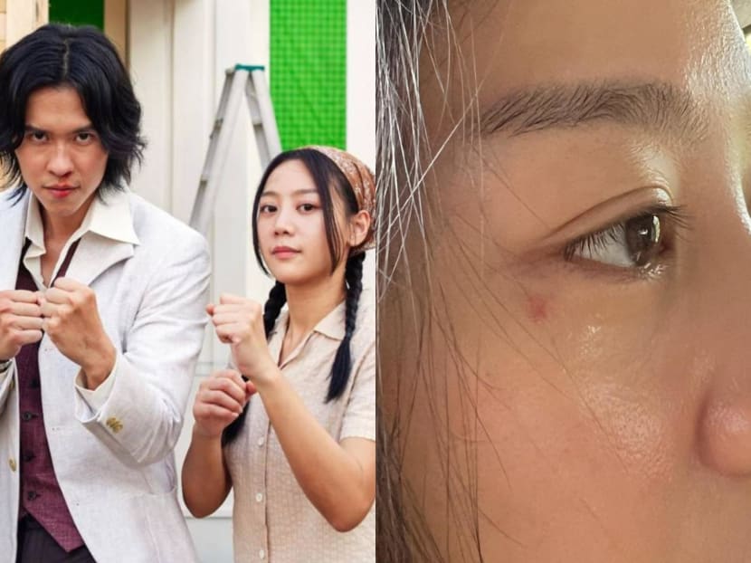 Actor Herman Keh accidentally scratched co-star Tasha Low's face while shooting a scene Actor Herman Keh accidentally scratched co-star Tasha Low's face while shooting a scene