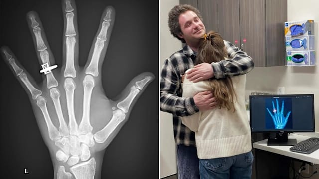 手腕受伤去急诊 她收获人生最闪亮时刻