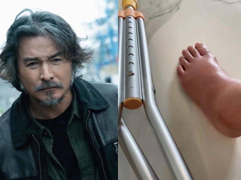 Actor Christopher Lee will miss the Golden Bell Awards ceremony in Taiwan because of a foot injury