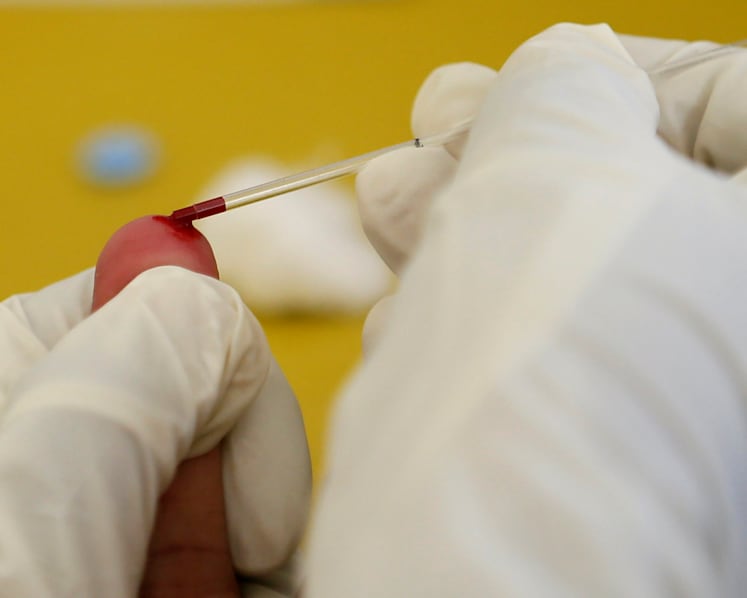 HIV data leak incident could recur unless multiple layers of checks are in place, say experts