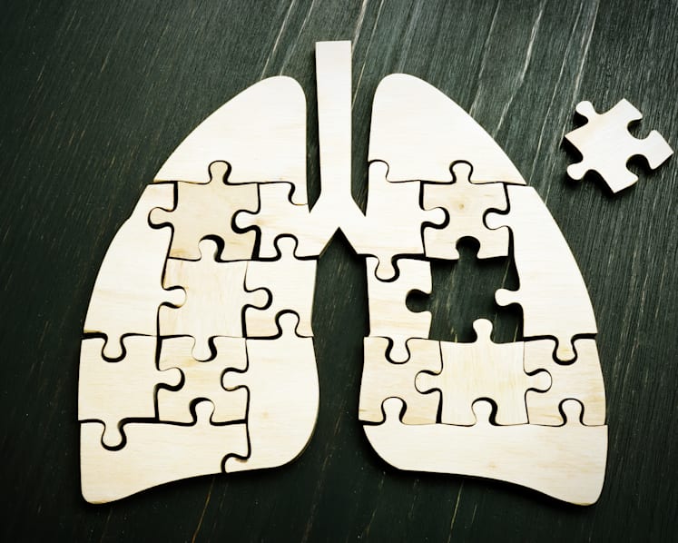 It started with a dry cough and fatigue, then non-smoker finds out she has stage 4 lung cancer