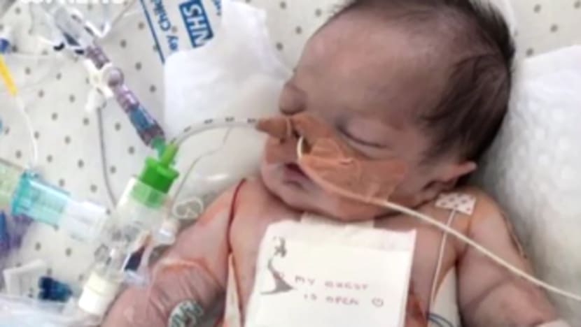 Bayi 9 bulan terkena 25 serangan jantung dalam tempoh sehari Bayi 9 bulan terkena 25 serangan jantung dalam tempoh sehari