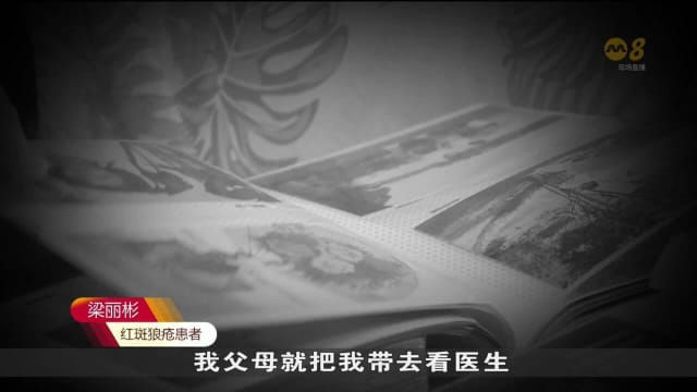 红斑狼疮无法根治 十年存活率提高到98%