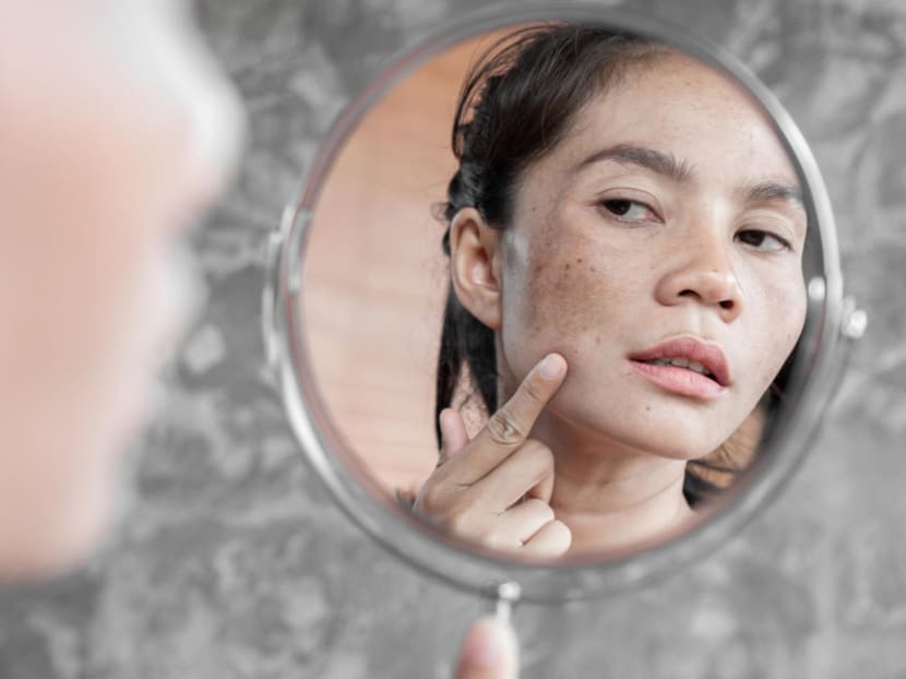 Vitamin C for skincare: How to combat pesky dark spots by using this powerhouse ingredient the right way Vitamin C for skincare: How to combat pesky dark spots by using this powerhouse ingredient the right way