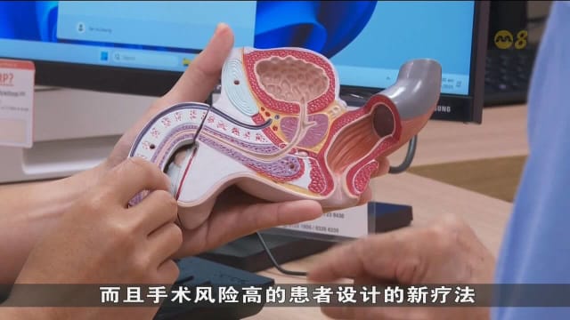 中央医院将化疗药物 直接导入膀胱进行局部治疗