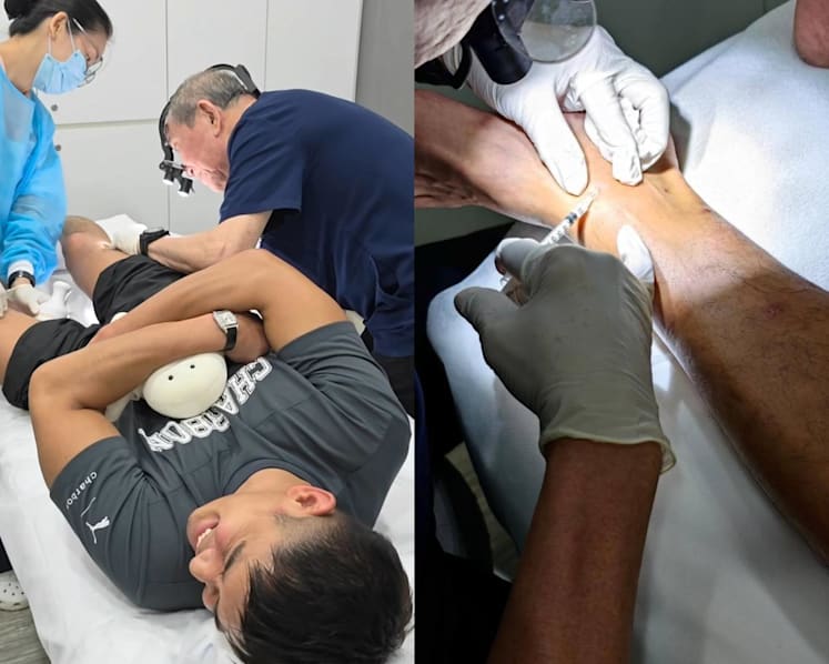 Elvin Ng had to get steroid jabs for sandfly bites after they became inflamed