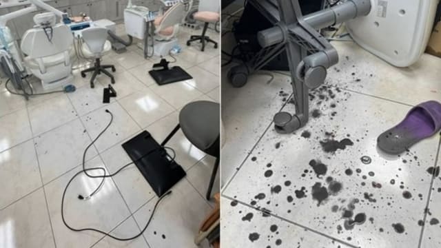 疑洗牙太痛 台男挥拳痛殴女牙医诊所满地血