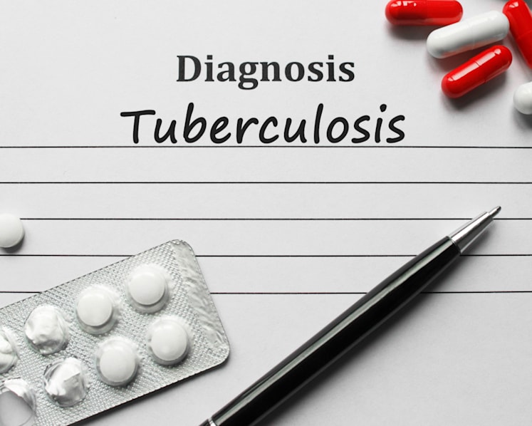 Explainer: Why are there still tuberculosis cases in Singapore and how does the disease spread?