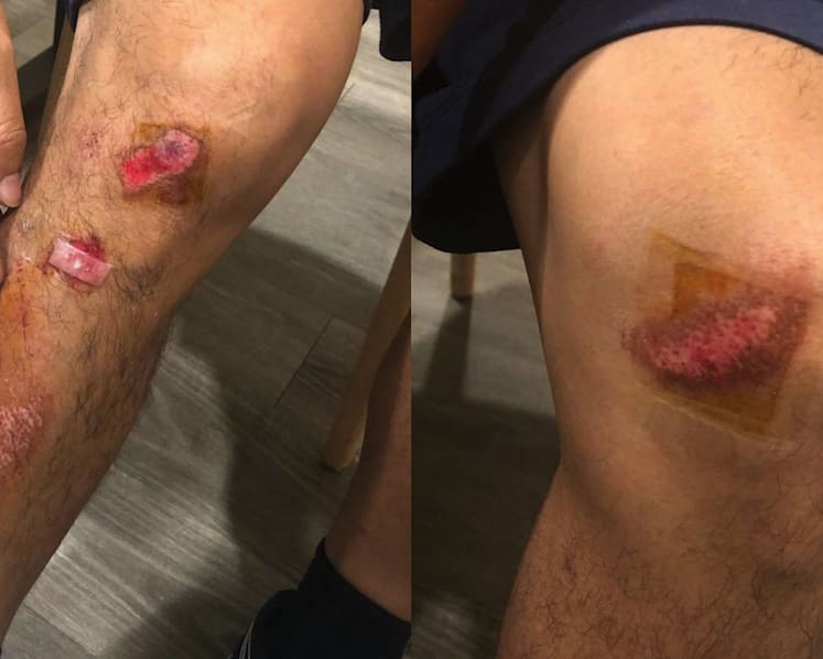 Jacky Wu Crashes Bike While Filming Variety Show; Says His Helmet