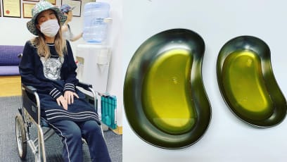 This Is How Much Fluid A Doctor Drained From Joey Yung’s Swollen Knees