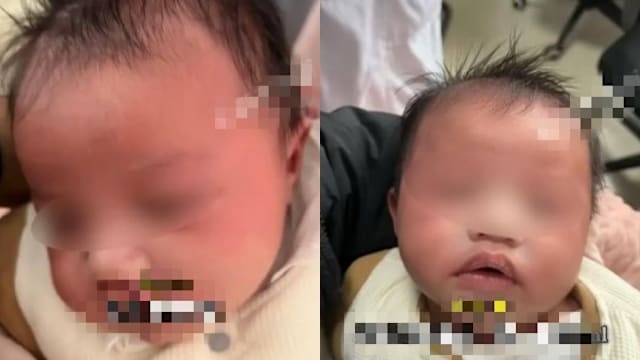 大意奶奶误把白酒当水来泡奶 一个月大男婴全身泛红急送院