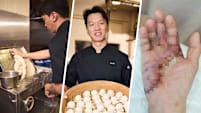 2nd-Gen Boss Of Tanjong Rhu Pau Nearly Lost His Hand In Dough Machine Accident
