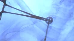 Related article image