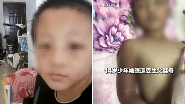 河南14岁男孩疑遭虐待亡 生父自首继母被捕