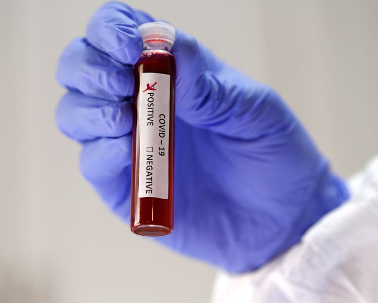 Secondary school student mistakenly diagnosed with Covid-19 due to human error at lab: MOH