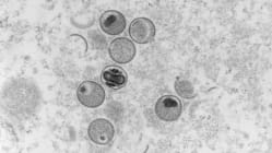 Related article image